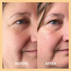 Miracle Vitamin C Mask