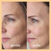 Miracle Vitamin C Mask