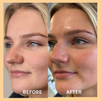 Miracle Vitamin C Mask