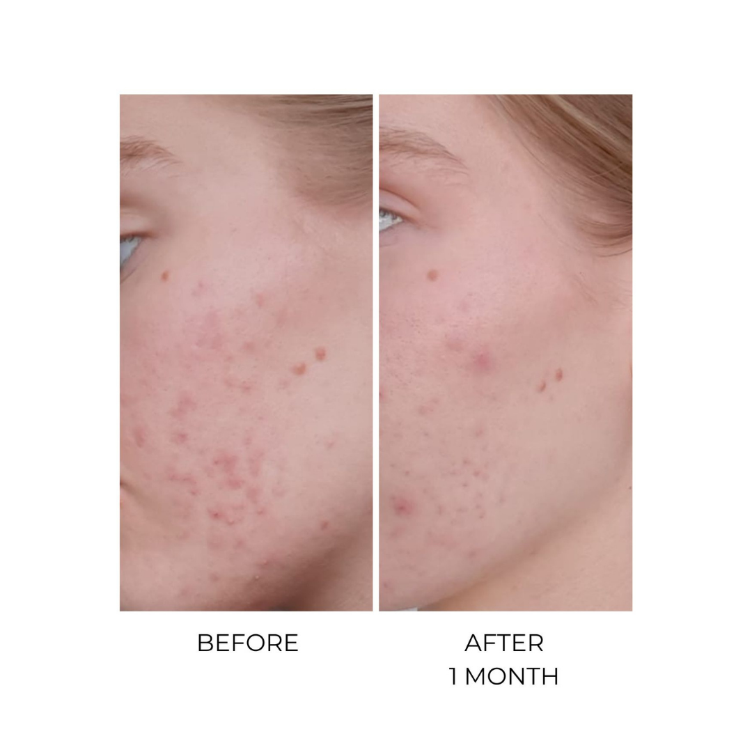 MSM Bio-Plus Supplement