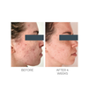 Violet Water Clearing Cleanser Blemish Control Facial Cleansing Gel