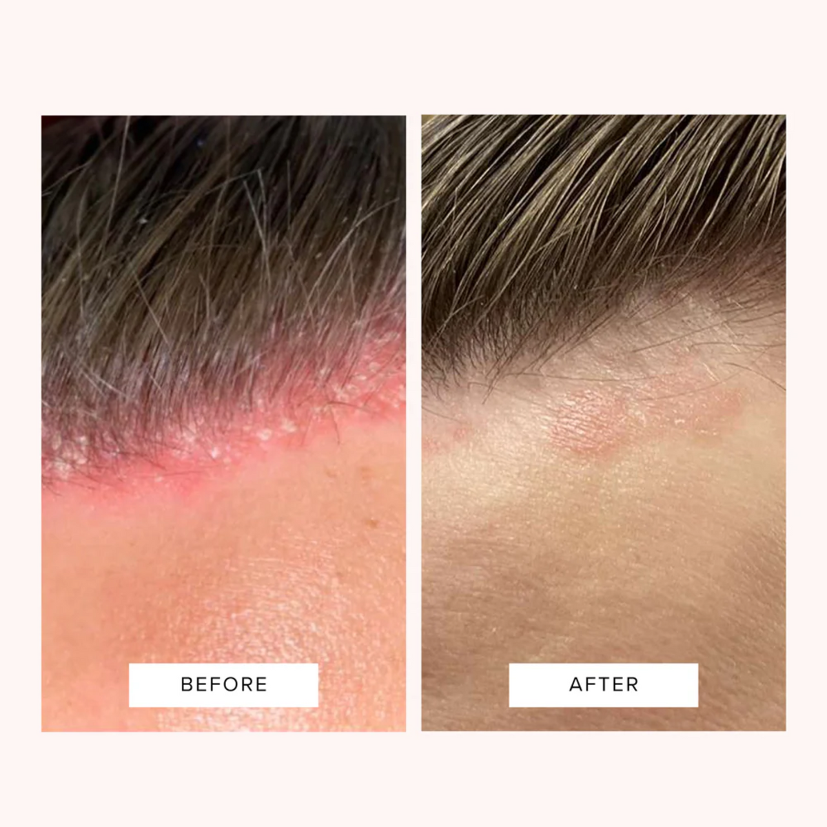 Hydrate & Soothe Scalp Serum