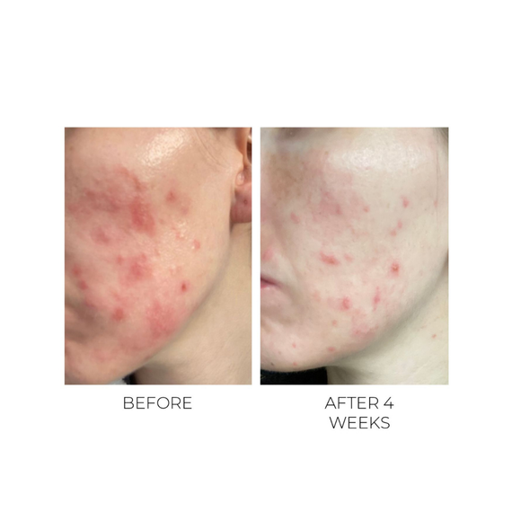 Violet Water Clearing Cleanser Blemish Control Facial Cleansing Gel