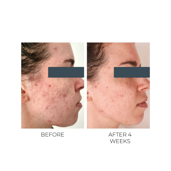 Violet Water Clearing Cleanser Blemish Control Facial Cleansing Gel