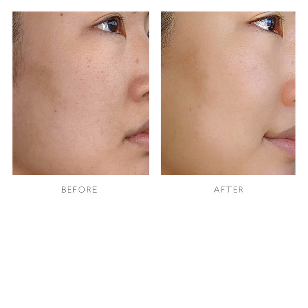 Resurfacing Serum